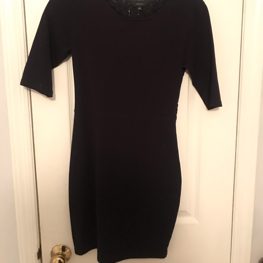 lace back dress (aritzia)